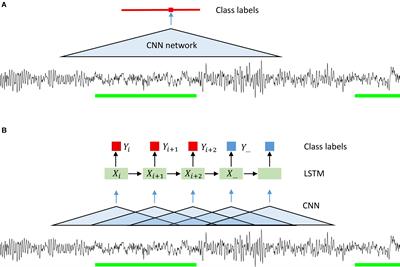 Automatic Detection of Microsleep Episodes With Deep Learning